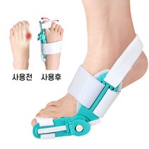 발가락 교정기 무지외반증교정기 엄지손가락교정기, 화이트, 2개