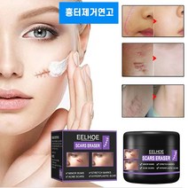 흉터제거연고 수술흉터제거 연고 화상상처 재생크림 여드름흉터 치료, 2개, 50ml