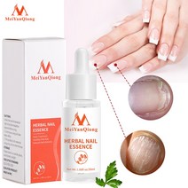 무좀 내성발톱 발톱무좀 썩은 네일 에센스 세럼 케어 30ml 치료 발 손톱 곰팡이 제거 젤 감염 방지 진균증, 한개옵션0