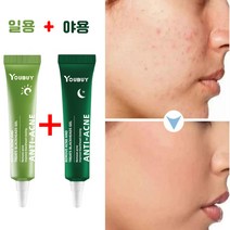 [일용+야용] 여드름 연고 여드름 흉터 치료 연고 여드름 흉터 리페어 크림