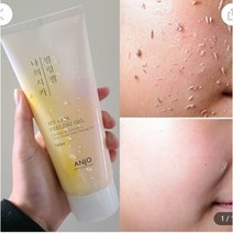 앙쥬 각질제거 나의시카 저자극 필링젤180ml, 180ml