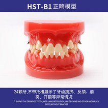 치아모형 인체모형도 치과기구 실리콘몰드 인체모형 양치교구 재료상, 교정 모델 B1 탈구 형태(24개 치아)