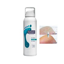 Footlogix 풋로직스 DD 크림 무스 125ml 발뒤꿈치갈라짐 발바닥케어