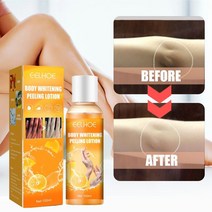 로션 화이트닝 크림 에이징 각질 바디 미백 피부 보습 비타민 C 필링 세럼 제거 무릎