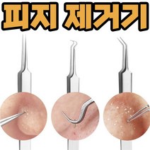 코피지 뽑기 압출 제거기 얼굴 블랙헤드 압출기, 갈고리형, 본상품선택