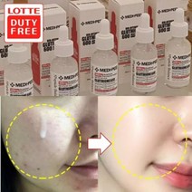 검버섯제거 기미뿌리제거 에센스 30ml/7일후 놀라운변화/미백기능성앰플 기미잡티제거, 4)미백에센스1개+줄기세포마스크30+원장님아이톡 2개