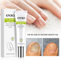 무좀 내성발톱 발톱무좀 곰팡이 네일 트리트먼트 세럼 발 제거 젤 손발톱 진균증 치료 에센스 크림 관리, 01 1pc