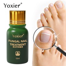 무좀 내성발톱 발톱무좀 Yoxier 곰팡이 네일 트리트먼트 항균 세럼 수리 거친 변색 방지 감염 Paronychia O, 한개옵션0
