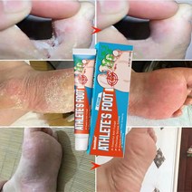 무좀약 연고 발톱무좀 치료 발냄새 제거 발 가려움 연고, 20g, 3개, 1개