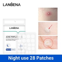 LANBENA-여드름 여드름 패치 페이스 마스크 보이지 않는 스티커 흠집 치료 리무버 마스터 도구 스킨 케어 페이셜 크림, [02] B