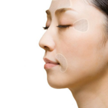 팔자주름패치 미간주름 눈가주름 주름 이마주름 패치, 둥근 타입
