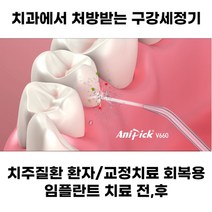 [1년 무상A/S] 애니픽 치과처방 가정용 구강세정기 APF-V660