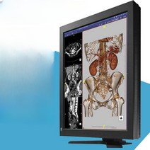 의료용 모니터 LCD 디스플레이 치과 컴퓨터 고화질, RX210 공식 표준