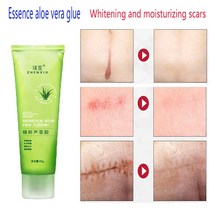 99% 알로에 수딩 젤 베라 주름 방지 여드름 흉터 치료 크림 선스크린 썬번 리페어 Vera