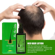 유니 천연 추출물 Germinal Pilatory NEO Hair Regrowth Lotion 대머리 수리 스프레이 탈모 오일 Haircare, 01 01