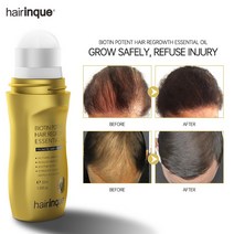 Hairinque-50ml 비타민 B7 탈모 방지 세럼 두피 트리트먼트 빠른 모발 성장 제품 남성 및 여성용 헤어 케어 오일
