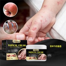 피부가려움증 크림 한포진 지루성피부염 습진연고 여드름 모낭염연고, 1개