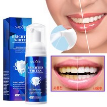 치아미백제 셀프 치아미백 치아 화이트닝 얼룩제거 구강 냄새제거, 1개, 60ml
