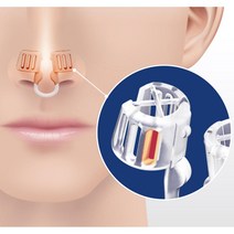 녹십자 코골이 방지기구 비강확장기 구강 기계 여성, 단품