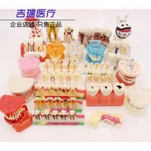 치아 모형 재료상 입모형 칫솔질 모형 치아 치과 충치 교구 치아모델 구강교습 교정재배모델, 03 비아 모형