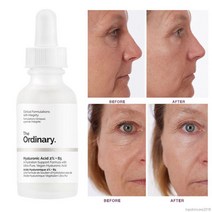 The Ordinary Hyaluronic Acid 2% + B5 디오디너리 히알루론산, 1개, 2oz