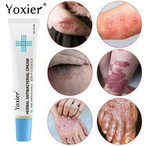 바디크림 yoxier 허브 건선 항진균성 가려움증 크림 릴리프 습진 피부염 두드러기