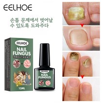(국내산/당일발송) EELHOE 1 1 발톱무좀 발톱무좀치료 발톱 무좀약 진균 리페어 에센스, 15ml * 2