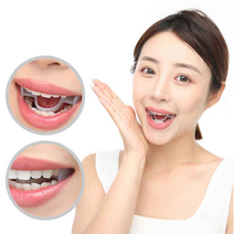 이갈이 마우스피스 방지 가드 투명 수면 용 유아 이가는 잠 잘때 악무는 선물