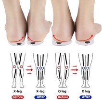 오다리교정 X다리 교정 교정 슬리퍼 교정 운동 교정기 오다리교정 X다리교정, L 코드(40-45)