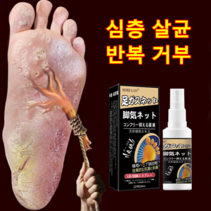 무좀을 겨냥하다 연구개발한 미스트, 1개, 1개입