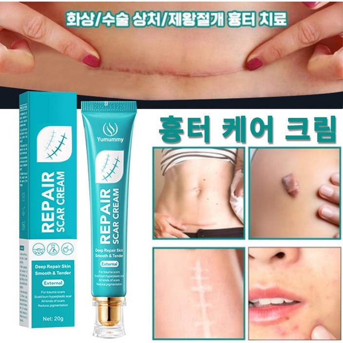 흉터제거연고화상수술흉터 흉터 연고 화상연고, 1개, 20g